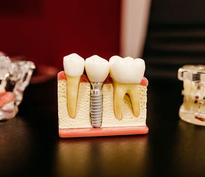Slider image (5) Neo Dental Clinic